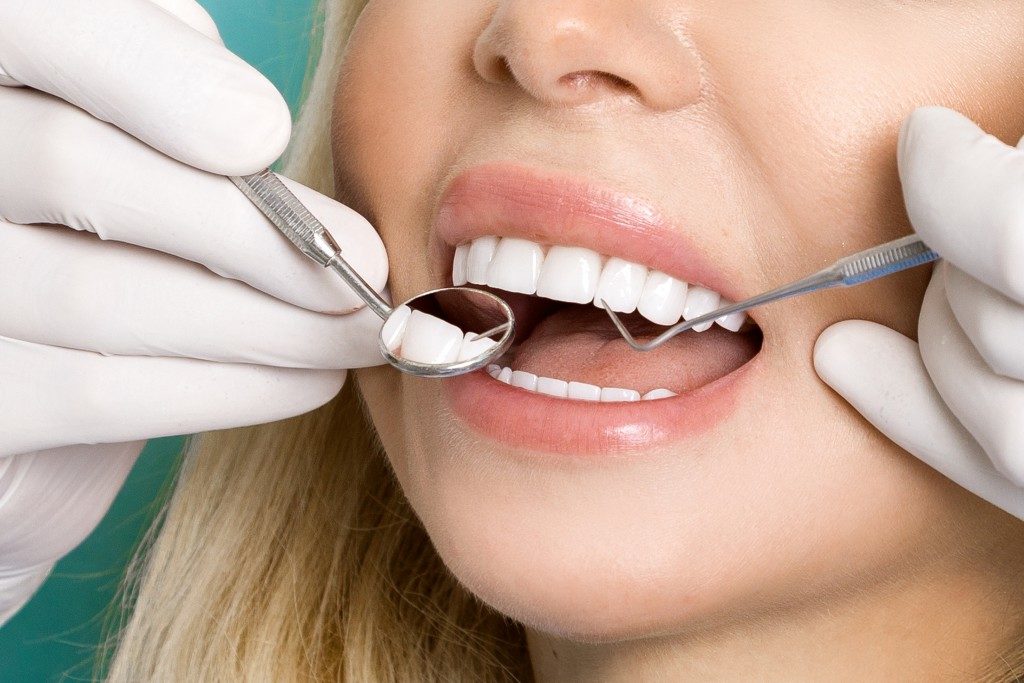 Keeing your Teeth Clean and Healthy