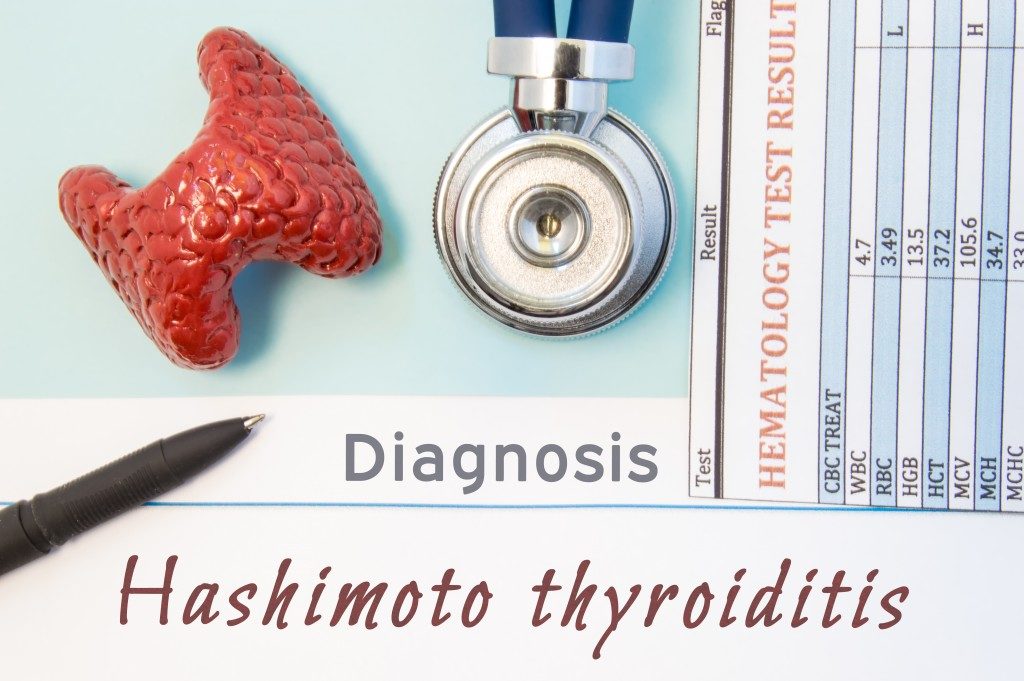 Endocrinology diagnosis Hashimoto's Thyroiditis