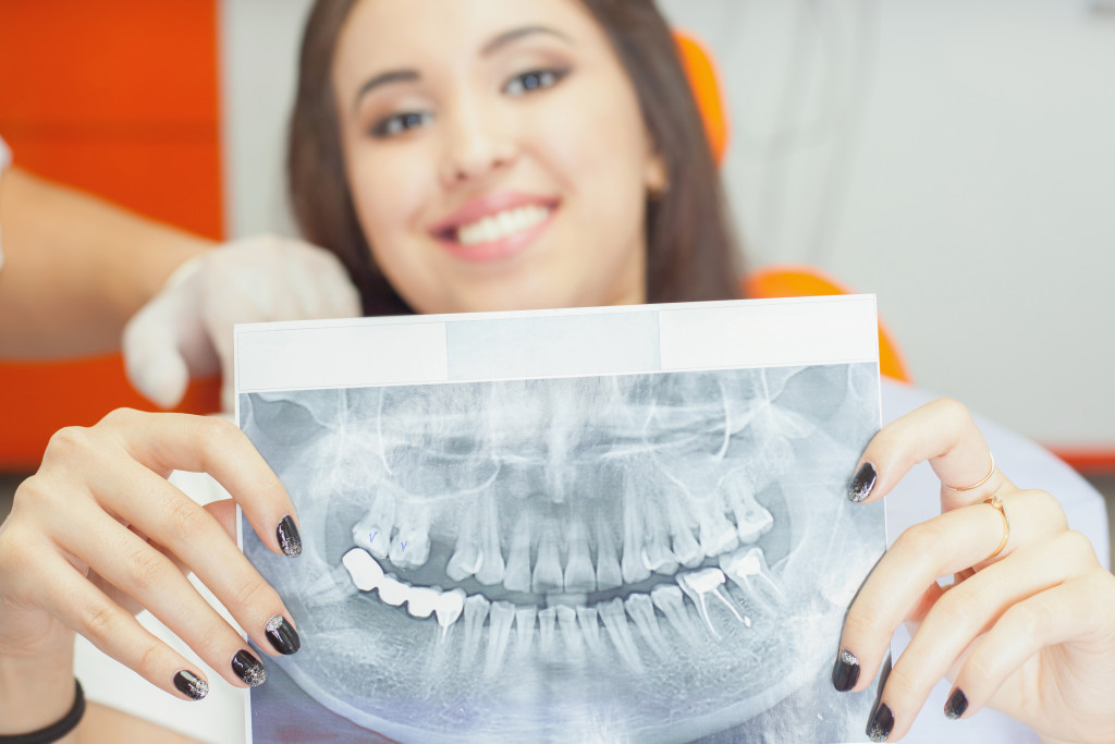 a woman showing dental xray result